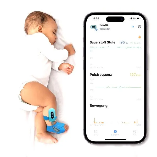Monitor snu w smartwatchu